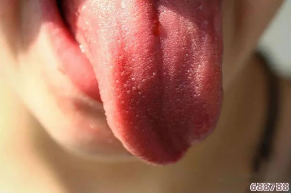 舌头探洞水好多怎么办？你不知道的护理技巧与应对方法分享！